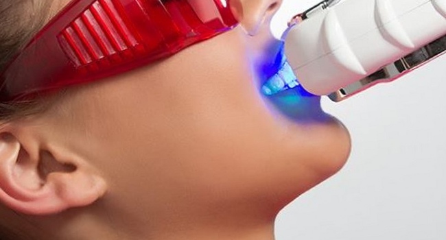 Система косметического отбеливания зубов